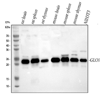 Anti-GLO1 Antibody