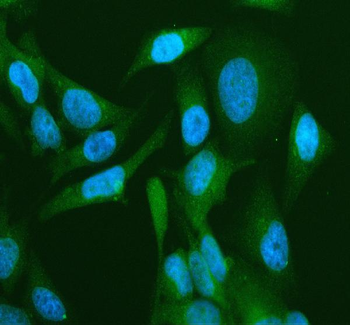 Anti-CD2AP Antibody