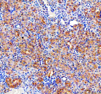 Anti-CD2AP Antibody