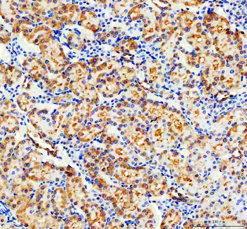 Anti-CD2AP Antibody