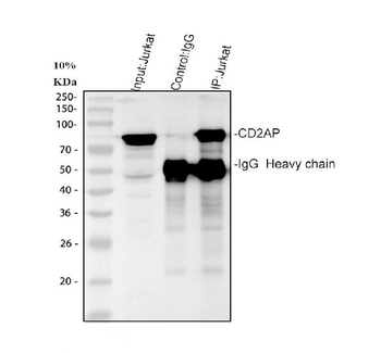 Anti-CD2AP Antibody