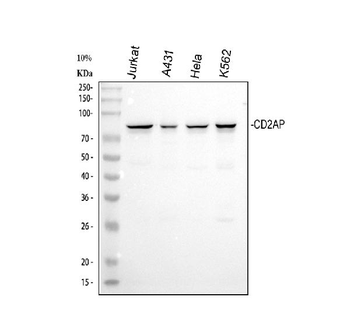 Anti-CD2AP Antibody