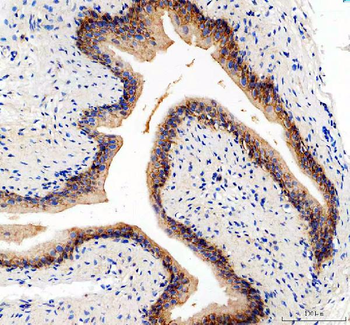 Anti-Integrin alpha 5/ITGA5 Antibody