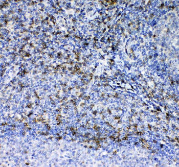 Anti-CD7 Antibody
