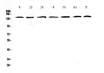 Anti-PERK/EIF2AK3 Antibody