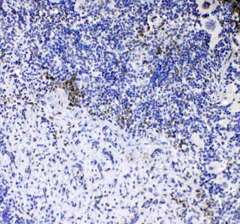 Anti-CD8 alpha/Cd8a Antibody