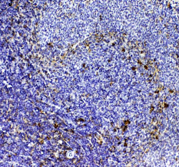 Anti-CD8 alpha/Cd8a Antibody