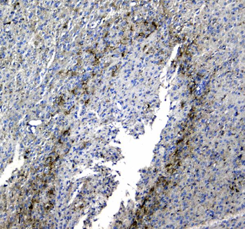 Anti-Synaptotagmin 1/SYT1 Antibody