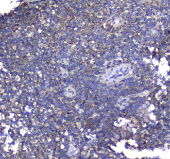 Anti-Synaptotagmin 1/SYT1 Antibody
