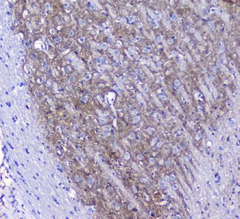 Anti-Synaptotagmin 1/SYT1 Antibody