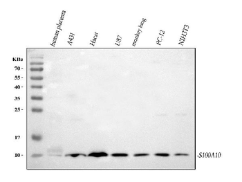 Anti-S100A10 Antibody