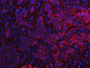 Anti-S100A10 Antibody