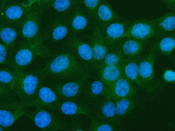 Anti-S100A10 Antibody