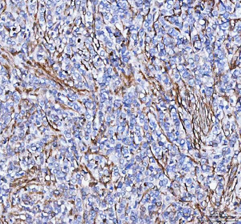 Anti-S100A10 Antibody