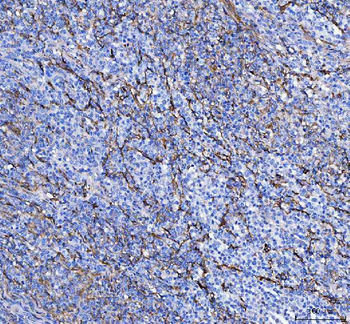 Anti-S100A10 Antibody