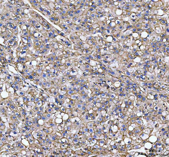 Anti-S100A10 Antibody