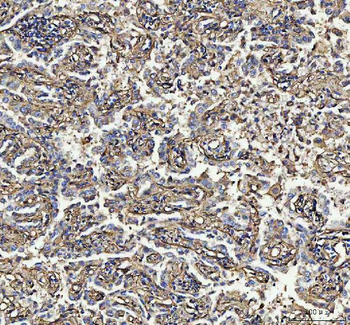 Anti-S100A10 Antibody