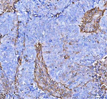Anti-S100A10 Antibody