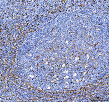 Anti-S100A10 Antibody