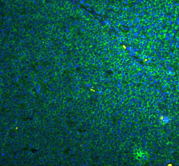 Anti-Caspase 4/CASP4 Antibody