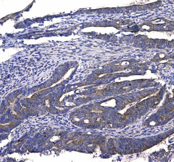 Anti-GSTM3 Antibody
