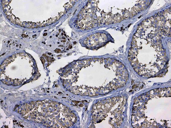 Anti-GSTM3 Antibody