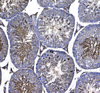 Anti-GSTM3 Antibody