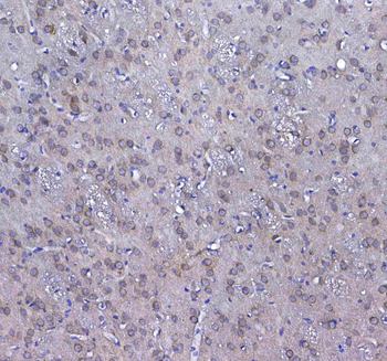 Anti-GSTM3 Antibody