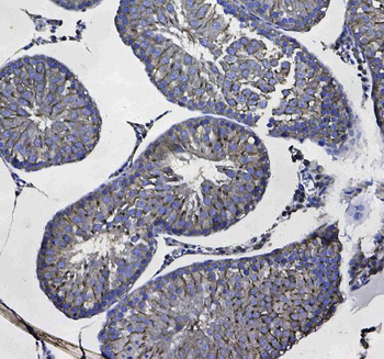 Anti-GSTM3 Antibody