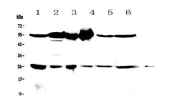 Anti-GSTM3 Antibody