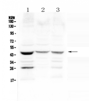 Prosurfactant Protein B/SFTPB Rabbit Polyclonal Antibody