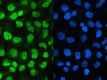 Anti-SAE2/UBA2 Antibody
