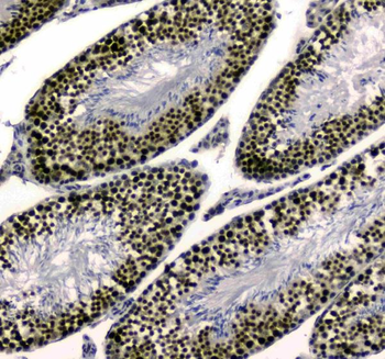 Anti-SAE2/UBA2 Antibody