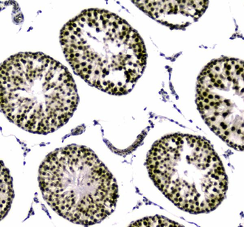 Anti-SAE2/UBA2 Antibody