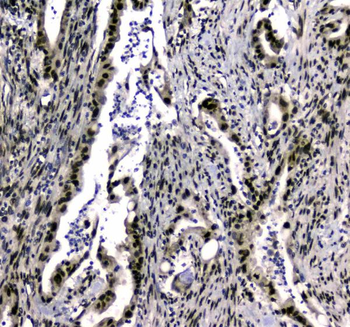 Anti-SAE2/UBA2 Antibody