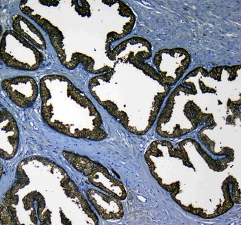 Kallikrein 2/KLK2 Rabbit Polyclonal Antibody