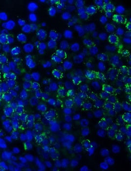 Anti-Myeloperoxidase/MPO Antibody
