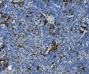 Anti-Myeloperoxidase/MPO Antibody