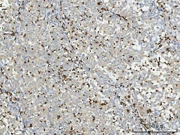 Anti-Myeloperoxidase/MPO Antibody