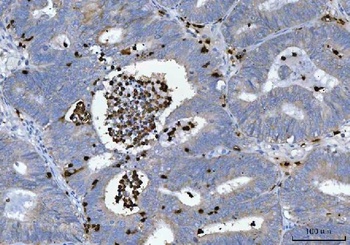 Anti-Myeloperoxidase/MPO Antibody