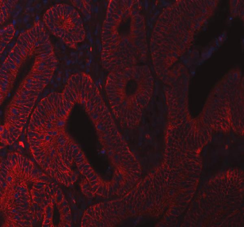 Anti-beta Catenin/CTNNB1 Antibody