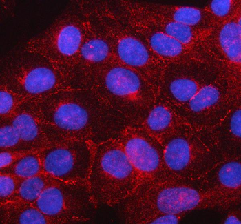 Anti-beta Catenin/CTNNB1 Antibody