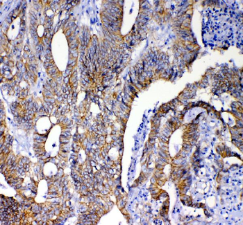 Anti-beta Catenin/CTNNB1 Antibody