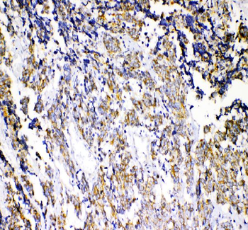 Anti-beta Catenin/CTNNB1 Antibody