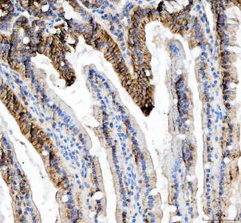 Anti-beta Catenin/CTNNB1 Antibody