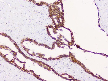 beta Catenin/CTNNB1 Antibody