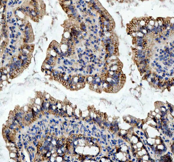 Anti-beta Catenin/CTNNB1 Antibody