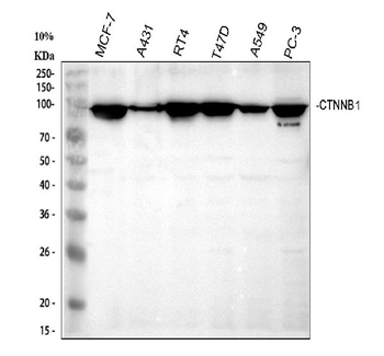 Anti-beta Catenin/CTNNB1 Antibody