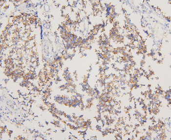 EGFR Antibody