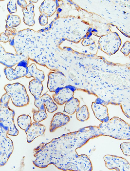 EGFR Antibody